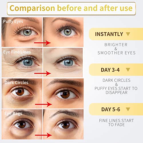 Revitalize Your Eyes: 60 Pcs 24K Gold Under Eye Patches for Puffy Eyes & Dark Circles - Collagen, Hyaluronic Acid & Castor Oil for Youthful Skin Care